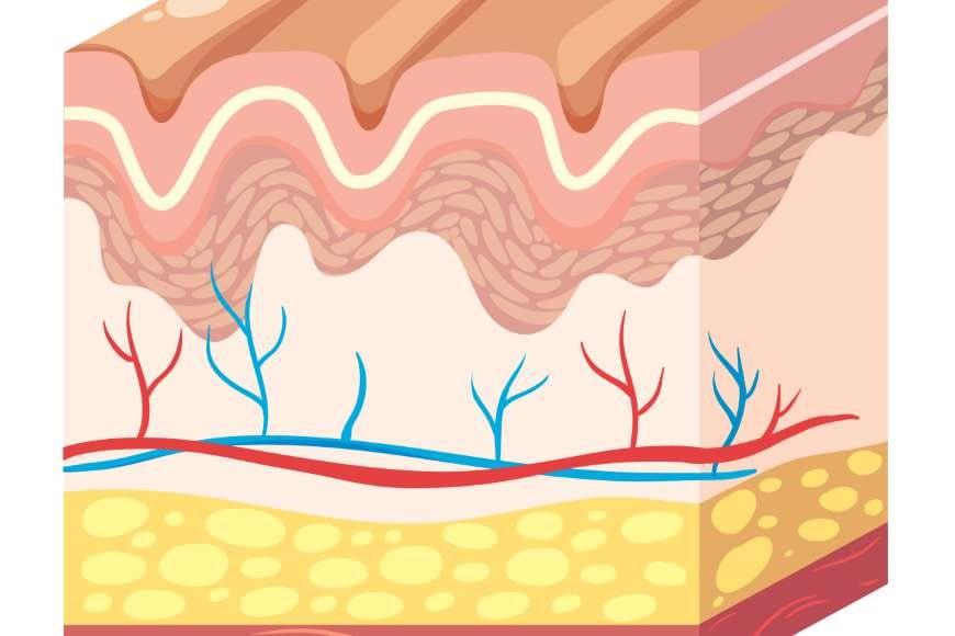 Telenjiektazi Nedir?